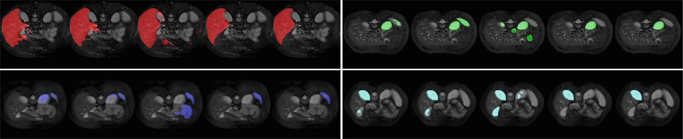 Qualitative abdominal organ segmentation results across four anatomical targets